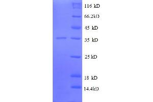 SDS-PAGE (SDS) image for Ribosomal Protein L31 (RPL31) (AA 1-70), (full length) protein (GST tag) (ABIN5712628)