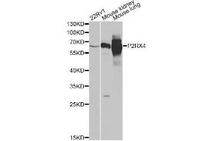 Western blot analysis of extracts of various cell lines, using P2RX4 antibody. (P2RX4 anticorps)