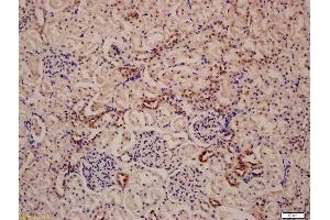 Formalin-fixed and paraffin embedded rat kidney labeled with Anti-LAMP-1 Polyclonal Antibody, Unconjugated  at 1:200 followed by conjugation to the secondary antibody and DAB staining
