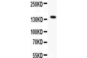 Anti- VEGFR antibody,  Western blotting All lanes: Anti VEGFR () at 0. (FLT1 anticorps  (N-Term))
