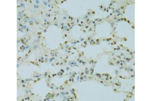 Immunohistochemistry of paraffin-embedded Rat lung using SAFB Polyclonal Antibody at dilution of 1:100 (40x lens). (SAFB anticorps)
