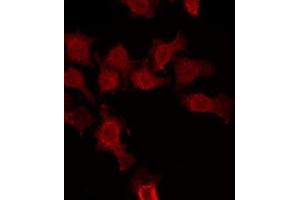 ABIN6275004 staining HuvEc by IF/ICC. (CLCNKA anticorps  (C-Term))