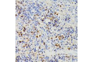 Immunohistochemistry of paraffin-embedded rat spleen using DUT antibody (ABIN7266736) at dilution of 1:100 (40x lens).