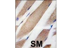 Formalin-fixed and paraffin-embedded human skeletal muscle tissue reacted with CLIC4 Antibody ABIN387769 , which was peroxidase-conjugated to the secondary antibody, followed by DAB staining.
