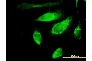 Immunofluorescence of purified MaxPab antibody to POLG2 on HeLa cell. (POLG2 anticorps  (AA 1-485))