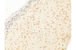 ABIN7094786 and ABIN7098837 at 1/100 staining Rat brain tissue by IHC-P. (TFAP4 anticorps  (C-Term))