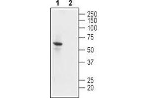 Western blot analysis of human U-87 MG glioblastoma cell lysate: - 1.