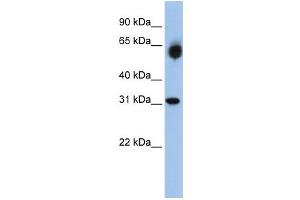 Western Blotting (WB) image for anti-Dehydrogenase/reductase (SDR Family) Member 2 (DHRS2) antibody (ABIN2458636) (DHRS2 anticorps)