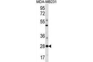 Western Blotting (WB) image for anti-Spi-B Transcription Factor (Spi-1/PU.1 Related) (SPIB) antibody (ABIN3000955) (SPIB anticorps)