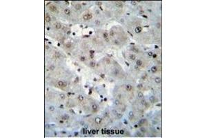 H2AFZ Antibody (C-term) (ABIN655184 and ABIN2844799) immunohistochemistry analysis in formalin fixed and paraffin embedded human liver tissue followed by peroxidase conjugation of the secondary antibody and DAB staining.