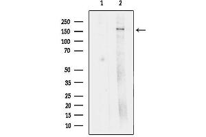 Western blot analysis of lysates from HeLa, using ZFYVE9 Antibody.