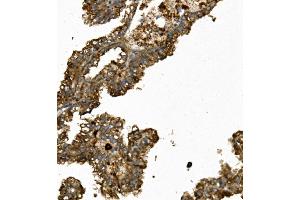 IHC analysis of REN/Renin using anti-REN/Renin antibody (ABIN7602836).