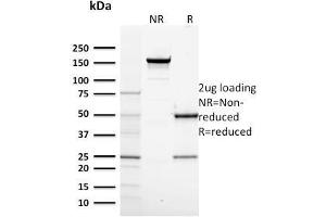 SDS-PAGE Analysis Purified RNA Poll II Mouse Monoclonal Antibody (CTD4H8). (POLR2A/RPB1 anticorps  (pSer5))
