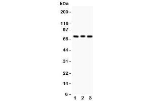 Western blot testing of PKC beta antibody and Lane 1:  rat brain