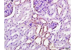 Paraformaldehyde-fixed, paraffin embedded Rat kidney, Antigen retrieval by boiling in sodium citrate buffer (pH6.