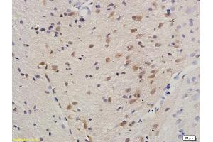 Formalin-fixed and paraffin embedded rat brain labeled with Anti-HDAC3/HD3 Polyclonal Antibody, Unconjugated (ABIN734903) at 1:200 followed by conjugation to the secondary antibody and DAB staining. (HDAC3 anticorps)