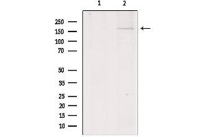 Western blot analysis of extracts from HepG2, using Collagen XIalpha 1 Antibody. (COL11A1 anticorps  (Internal Region))