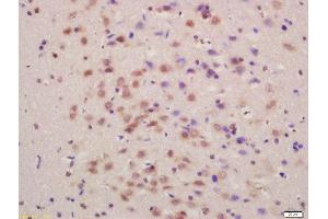 Formalin-fixed and paraffin embedded rat brain labeled with Anti-SLC7A5 Polyclonal Antibody, Unconjugated  at 1:200 followed by conjugation to the secondary antibody and DAB staining (SLC7A5 anticorps  (AA 101-200))