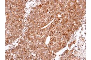 IHC-P Image Immunohistochemical analysis of paraffin-embedded H520 xenograft, using Histamine H2 Receptor, antibody at 1:100 dilution. (HRH2 anticorps  (N-Term))