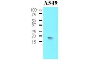 Western Blotting (WB) image for anti-Protein Phosphatase 1, Regulatory (Inhibitor) Subunit 14A (PPP1R14A) (AA 1-147), (N-Term) antibody (ABIN302213)