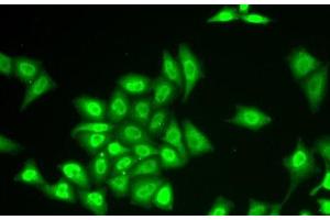 Immunofluorescence analysis of U2OS cells using ZNF217 Polyclonal Antibody (ZNF217 anticorps)