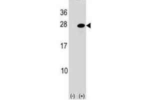 Western blot analysis of ATF3 antibody and 293 cell lysate (2 ug/lane) either nontransfected (Lane 1) or transiently transfected (2) with the ATF3 gene. (ATF3 anticorps  (AA 140-168))