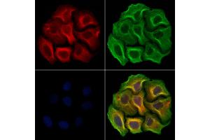 ABIN7094469 and ABIN7098517 staining Hela cells by IF/ICC.