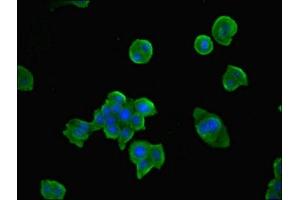 Immunofluorescent analysis of PC-3 cells using ABIN7171975 at dilution of 1:100 and Alexa Fluor 488-congugated AffiniPure Goat Anti-Rabbit IgG(H+L)
