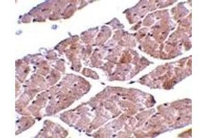 Immunohistochemistry (IHC) image for anti-Transient Receptor Potential Cation Channel, Subfamily C, Member 3 (TRPC3) (C-Term) antibody (ABIN1030778) (TRPC3 anticorps  (C-Term))