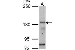 WB Image Sample (30 ug of whole cell lysate) A: HCT116 5% SDS PAGE antibody diluted at 1:500 (POLR3A anticorps  (N-Term))