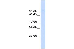 WB Suggested Anti-ZNF224 Antibody Titration: 0. (ZNF224 anticorps  (Middle Region))