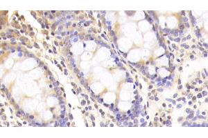 Detection of SIRT3 in Human Colon Tissue using Polyclonal Antibody to Sirtuin 3 (SIRT3)