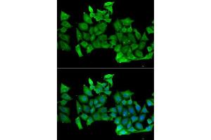 Immunofluorescence analysis of MCF-7 cells using RHOH antibody. (RHOH anticorps  (AA 1-191))