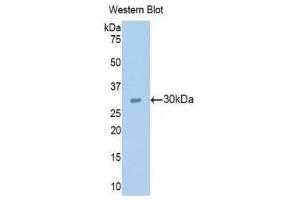 Western Blotting (WB) image for anti-Ribonuclease L (2',5'-Oligoisoadenylate Synthetase-Dependent) (RNASEL) (AA 358-583) antibody (ABIN1860458) (RNASEL anticorps  (AA 358-583))
