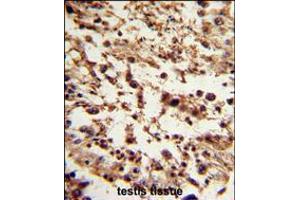 Formalin-fixed and paraffin-embedded human testis tissue reacted with TBP Antibody , which was peroxidase-conjugated to the secondary antibody, followed by DAB staining. (TBP anticorps  (C-Term))