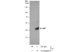 IP Image Immunoprecipitation of p40 protein from A431 whole cell extracts using 5 μg of p40 antibody [N3C3], Western blot analysis was performed using p40 antibody [N3C3], EasyBlot anti-Rabbit IgG  was used as a secondary reagent. (RABEPK anticorps)