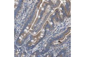 Immunohistochemical staining of human duodenum with DOLPP1 polyclonal antibody  shows moderate positivity in glandular cells. (DOLPP1 anticorps)
