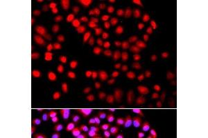 Immunofluorescence analysis of A549 cells using SETD6 Polyclonal Antibody