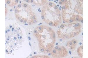 IHC-P analysis of Human Kidney Tissue, with DAB staining. (ADAM9 anticorps  (AA 440-680))