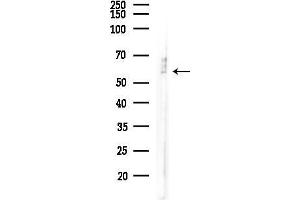 Western blot analysis of lysates from LoVo cells(heat-shock,45 min treatment), using SERPINF2 Antibody at 1/1000 dilution.