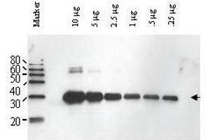 Western blot using  Affinity Purified anti-Yeast ULP-1 antibody shows detection of a truncated ULP-1 fusion protein (arrowhead).