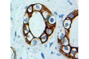 IHC-P analysis of Kidney tissue, with DAB staining.