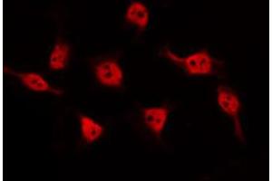 ABIN6274676 staining HeLa by IF/ICC. (BARD1 anticorps  (Internal Region))