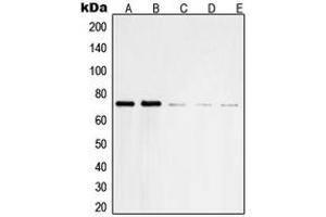 Western blot analysis of SHPTP2 expression in HeLa (A), Jurkat (B), NIH3T3 (C), U937 (D), A431 (E) whole cell lysates. (SHPTP2 (Center) anticorps)