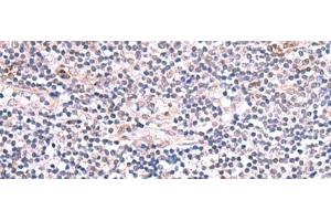 Immunohistochemistry of paraffin-embedded Human tonsil tissue using INPP5K Polyclonal Antibody at dilution of 1:85(x200) (INPP5K anticorps)