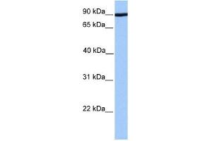 ADAM2 antibody used at 1 ug/ml to detect target protein. (ADAM2 anticorps)