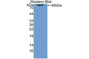 Western Blotting (WB) image for anti-Vitamin D-Binding Protein (GC) (AA 17-476) antibody (ABIN1980543) (Vitamin D-Binding Protein anticorps  (AA 17-476))