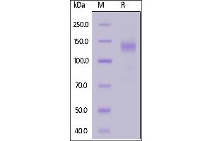 SARS-CoV-2 S1 protein, Fc Tag on  under reducing (R) condition.