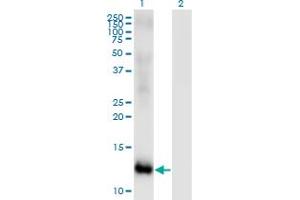 Western Blot analysis of MSRB2 expression in transfected 293T cell line by MSRB2 monoclonal antibody (M01), clone 2B7. (MSRB2 anticorps  (AA 102-201))