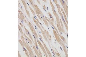 (ABIN6242408 and ABIN6577250) staining RANBP9 in human heart tissue sections by Immunohistochemistry (IHC-P - paraformaldehyde-fixed, paraffin-embedded sections).